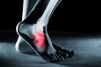 Common Types of Foot Pain