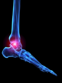 Foot Care for Psoriatic Arthritis